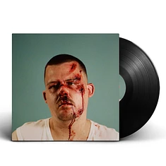 Efkaes & The Breed - Scheisse Passiert